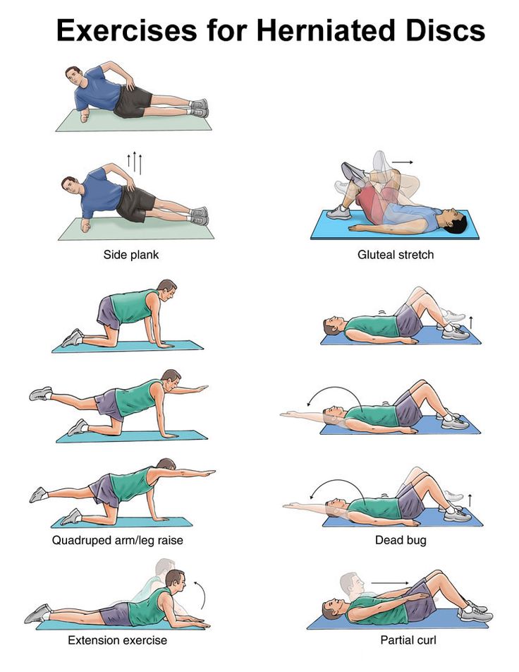 disc herniation exercises